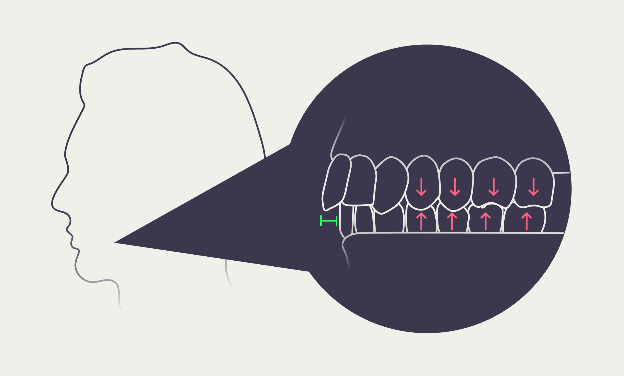 Mewing 101: The Beginner's Guide - MoveWell™