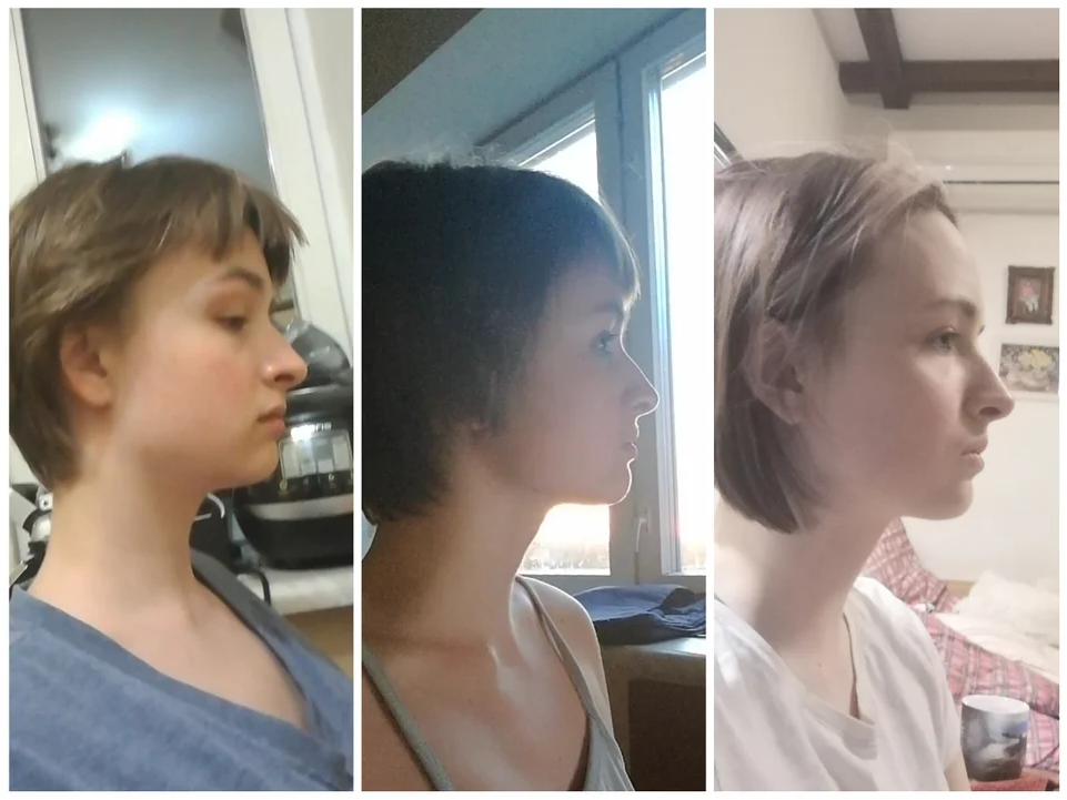 Beet mewing before and afters #fyp #mewing #jawline, Jawline